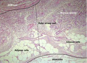 adipose tissue in the airways